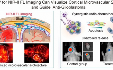 Nano Lett：X射线激活的纳米前药用于皮质微血管改变的可视化和NIR-II成像指导的放化疗