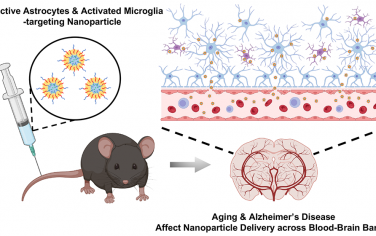 Nano Lett：阿尔茨海默病病理和年龄对于脑内纳米颗粒转运的影响