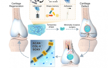 Nat Commun：超耐用的无细胞生物活性水凝胶，具有快速形状记忆和按需药物释放，用于软骨再生