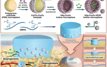Adv. Mater：超顺磁性复合水凝胶支架可作为骨关节炎的体内动态监测诊疗平台