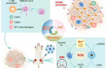 ACS Nano：包封二氧化锰的树状聚合物可共递送蛋白质和核苷酸以用于MRI指导的化学动力学/饥饿/免疫治疗