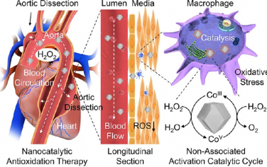 JACS：具有仿生结构的钴纳米催化剂可通过催化抗氧化抑制主动脉夹层进展