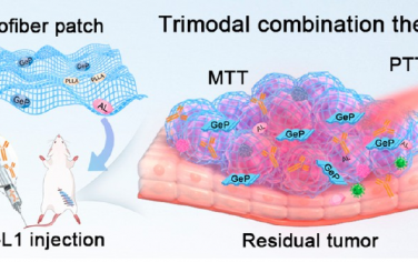 ACS Nano：原位纳米纤维补片可通过三模态联合治疗增强术后肝细胞癌的免疫激活