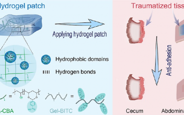 ACS Nano：具有组织仿生力学特性的非溶胀水凝胶贴片可重塑体内微环境以有效预防粘连