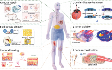 AFM：调整光热水凝胶的物理化学性质以实现内在再生疗法