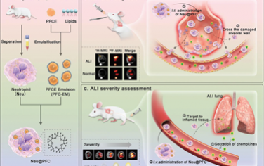 Adv. Mater：纳米工程化中性粒细胞可作为19F-MRI示踪剂以用于急性肺损伤的预警诊断和严重程度评估
