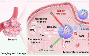 ACS Nano：光激活产气的纳米造影剂用于实现长期超声成像引导的肿瘤联合治疗