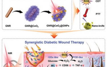 Adv Mater：Plasmonic超分子纳米酶协同诊疗糖尿病伤口