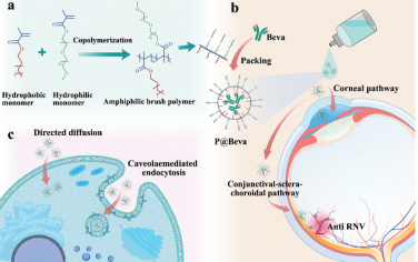 Adv. Mater：利用超小聚合物胶束增强Beva的眼内递送以实现无创的抗VEGF治疗