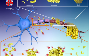 ACS Nano：双功能Gd@C82纳米粒子可通过抑制Aβ聚集减轻阿尔茨海默病中的神经元细胞毒性