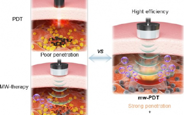 ACS Nano：具有双刺激纳米响应包覆层的无线供能微波-光转换平台用于深层光动力治疗