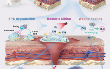 Adv. Mater：具有抗生物膜作用的工程化益生菌生物异质结可通过“食用”胞外聚合物促进伤口再生