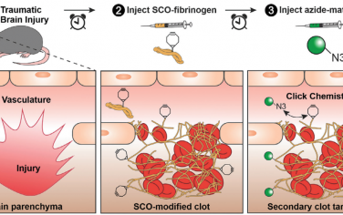 Adv. Mater：重编程血凝块以实现对创伤性脑损伤的体内化学靶向治疗