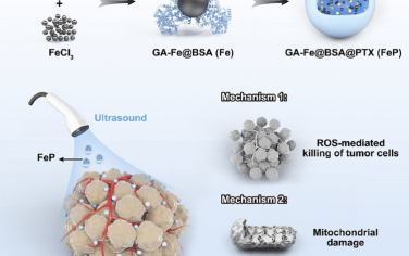 Biomaterials：超声增强的纳米催化剂可通过铁死亡-凋亡联合策略治疗转移性葡萄膜黑色素瘤