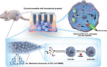 Adv. Mater：多功能冷冻微针贴片用于实现可示踪的光动力治疗