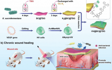 Adv. Mater：光敏剂和细胞夹心的细菌纤维素可作为活性人工皮肤以用于慢性伤口愈合