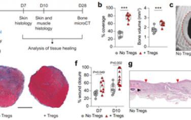Nat. Commun：局部注射调节性T细胞可促进组织愈合