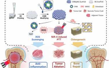Adv. Mater：基于光热催化还原和骨组织工程的“三合一”骨肉瘤治疗策略