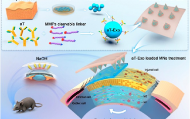 ACS Nano：负载间充质基质细胞外泌体的微针用于促进角膜化学损伤后的愈合