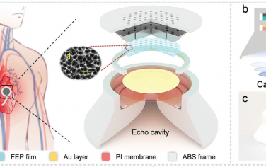 Adv. Mater：声增强摩擦电听诊器用于超灵敏心音感知和疾病诊断