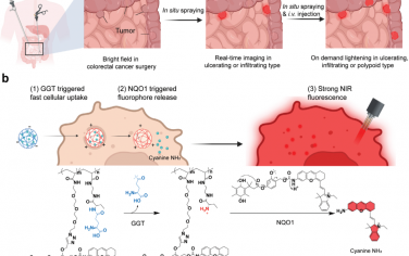 Adv. Mater：可注射、可喷涂的荧光纳米探针用于快速实时检测人结直肠肿瘤