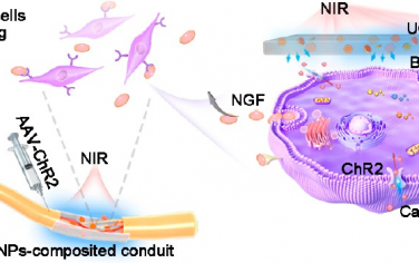 Nano Lett：上转换纳米颗粒介导的术后无创光遗传刺激用于促进坐骨神经修复