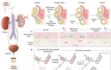 Angew：定制两性离子半花菁探针以用于急性肾功能衰竭的早期诊断和预后评估