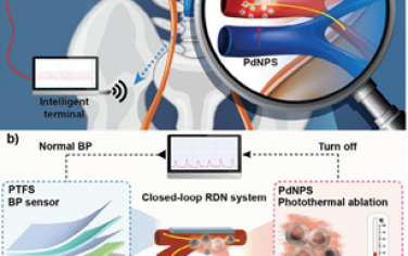 Adv. Mater：基于压电传感器和Pd纳米壳光热消融的闭环纳米系统用于肾脏去神经化以治疗高血压