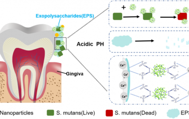 ACS Nano：壳聚糖植酸盐纳米粒子用于协同性预防龋齿