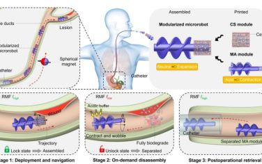 Science Advances：具有锁定和可拆卸模块的模块化微型机器人，用于胆管中的靶向细胞输送