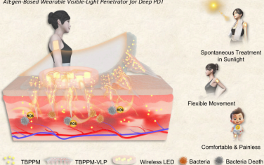 ACS Nano：基于AIE发光原的可穿戴式可见光穿透器用于实现深度光动力治疗
