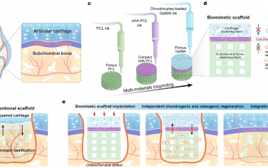 Bioact. Mater.：利用具有钙化界面层的 3D 打印仿生支架增强骨软骨再生