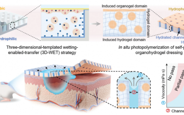 Adv. Mater：黏性-生物流体自泵有机水凝胶敷料用于加速糖尿病伤口的愈合