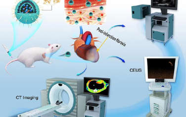 ACS Nano：靶向胶原的自组装纳米探针用于对心肌梗死大鼠模型的心肌纤维化进行多模态分子成像和定量