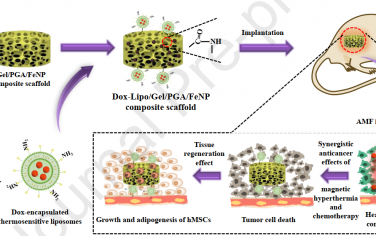 Biomaterials：智能复合支架可同步实现磁热和化疗以有效治疗乳腺癌