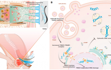 Nat. Commun：能够可控释放光基因工程化细胞外囊泡的自供电摩擦电响应型微针用于修复椎间盘退变