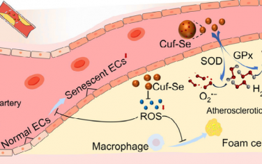 Nano Lett：硒掺杂的甲酸铜纳米酶可抗衰老和减少氧化应激以治疗动脉粥样硬化