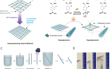 Adv. Mater：葡萄糖响应性插管用于实现自动、无需电子设备的胰岛素递送