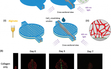 AFM：具有集成血管层次的厚脂肪组织的 3D 生物打印