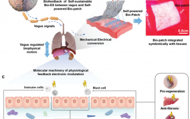 Adv. Mater.: 用于软器官生理反馈电子调节的自粘自持生物电子贴片