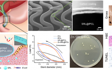 Bioactive Materials：具有纳米工程表面的3D打印多功能胆道支架用于抗增生和抗生物膜形成