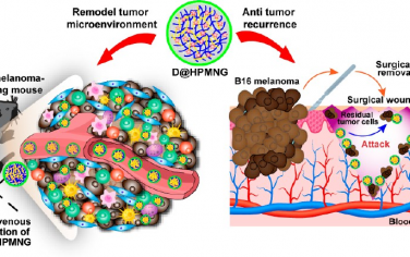 Nano Lett：纳米凝胶可通过重编程肿瘤相关巨噬细胞以用于恶性黑色素瘤的术前和术后治疗